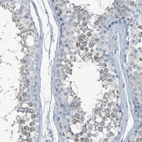 Immunohistochemical staining of human testis shows moderate granular cytoplasmic positivity in a subset of cells in seminiferous ducts.
