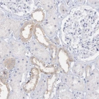 Immunohistochemical staining of human kidney shows moderate cytoplasmic positivity in cells in distal tubules.