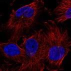 Immunofluorescent staining of human cell line U-251 MG shows localization to centrosome.