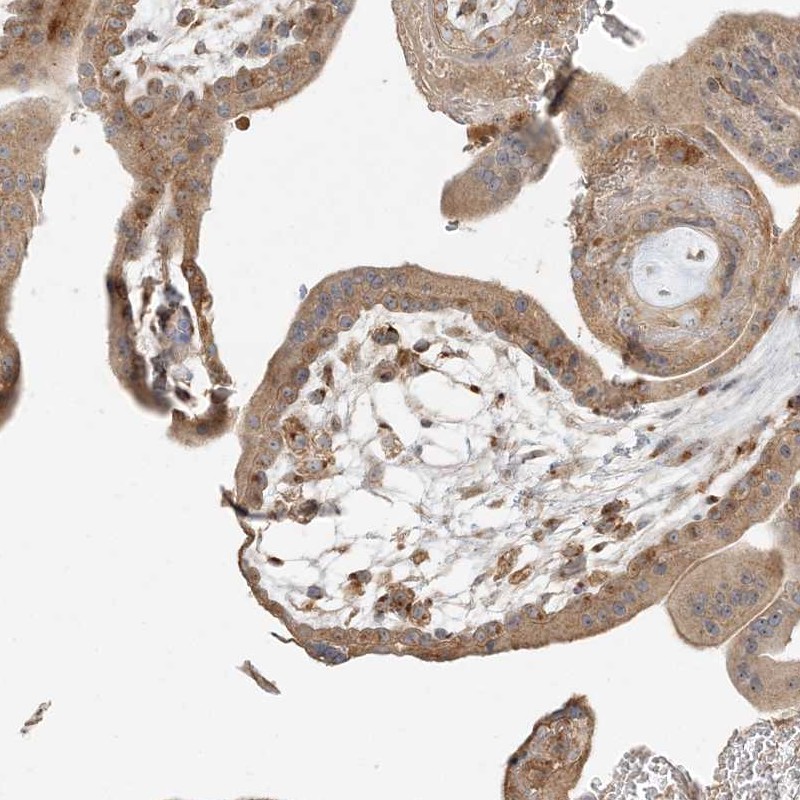 Anti-AP1AR Antibody