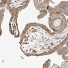 Anti-AP1AR Antibody