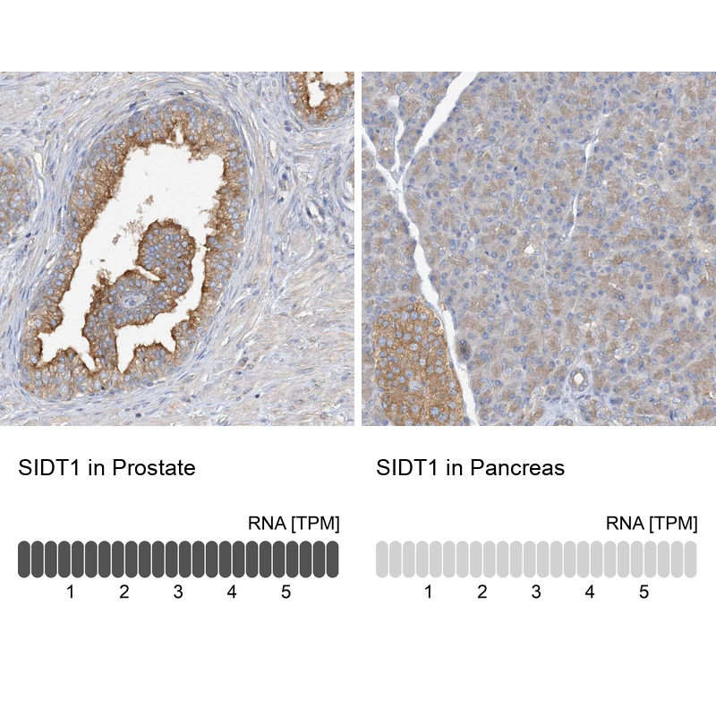 Anti-SIDT1 Antibody