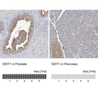 Anti-SIDT1 Antibody