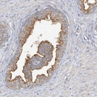 Immunohistochemical staining of human prostate shows high expression.