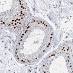 Anti-H2AFY2 Antibody