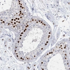 Immunohistochemical staining of human testis shows strong nuclear positivity in cells in seminiferous ducts.