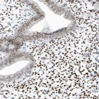 Immunohistochemical staining of human endometrium shows moderate to strong nuclear positivity in stromal cells.