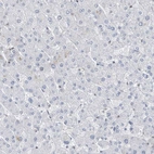 Immunohistochemical staining of human liver shows no positivity in hepatocytes as expected.