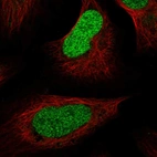 Immunofluorescent staining of human cell line U-2 OS shows localization to nucleoplasm.