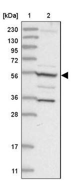 Lane 1: Marker [kDa] 230, 130, 95, 72, 56, 36, 28, 17, 11_br/_Lane 2: Human cell line RT-4