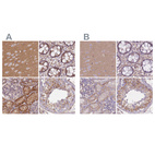 Anti-ADD1 Antibody