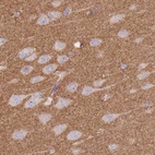 Immunohistochemical staining of human cerebral cortex using Anti-ADD1 antibody HPA035873.