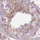 Immunohistochemical staining of human testis using Anti-ADD1 antibody HPA035873.