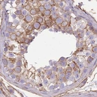 Immunohistochemical staining of human testis using Anti-ADD1 antibody HPA035873.