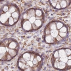 Immunohistochemical staining of human colon using Anti-ADD1 antibody HPA035873.