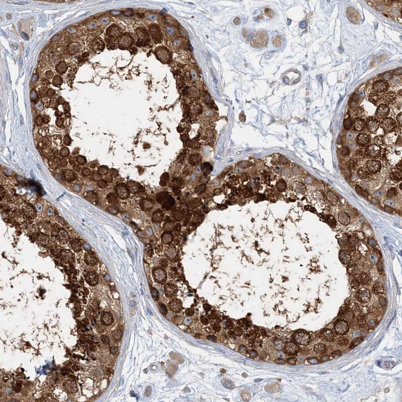 Anti-FAM114A2 Antibody