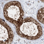 Anti-FAM114A2 Antibody