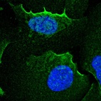 Immunofluorescent staining of human cell line U-2 OS shows localization to nuclear bodies & plasma membrane.