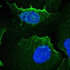 Immunofluorescent staining of human cell line U-2 OS shows localization to nuclear bodies & plasma membrane.