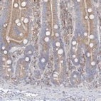 Immunohistochemical staining of human duodenum shows moderate cytoplasmic positivity in glandular cells.