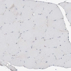 Immunohistochemical staining of human skeletal muscle shows no positivity in myocytes as expected.