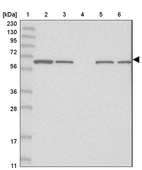 Lane 1: Marker [kDa] 230, 130, 95, 72, 56, 36, 28, 17, 11_br/_Lane 2: Human cell line RT-4_br/_Lane 3: Human cell line U-251MG sp_br/_Lane 4: Human plasma (IgG/HSA depleted)_br/_Lane 5: Human liver tissue_br/_Lane 6: Human tonsil tissue
