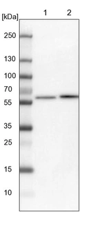 Lane 1: NIH-3T3 cell lysate (Mouse embryonic fibroblast cells)_br/_Lane 2: NBT-II cell lysate (Rat Wistar bladder tumour cells)