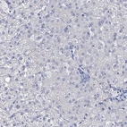 Immunohistochemical staining of human liver shows no positivity in hepatocytes as expected.