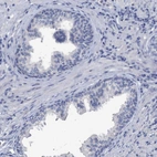 Immunohistochemical staining of human prostate shows no positivity in glandular cells as expected.