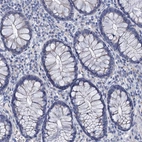 Immunohistochemical staining of human rectum shows no positivity in glandular cells as expected.
