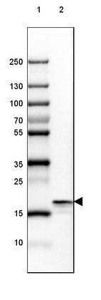 Anti-SNCB Antibody