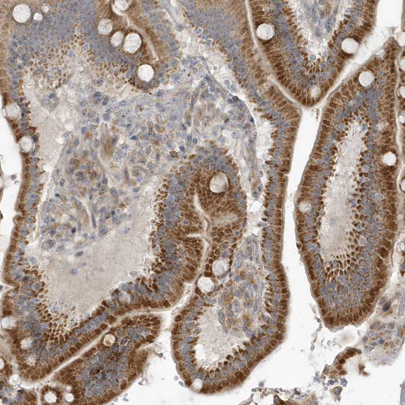 Anti-THG1L Antibody