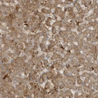 Immunohistochemical staining of human liver shows moderate granular cytoplasmic positivity in hepatocytes.