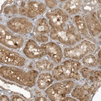 Immunohistochemical staining of human kidney shows moderate granular cytoplasmic positivity in cells in tubules.