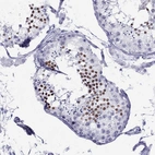 Immunohistochemical staining of human testis shows strong nuclear positivity in cells in seminiferous ducts.