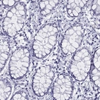 Immunohistochemical staining of human rectum shows no positivity in glandular cells as expected.