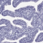 Immunohistochemical staining of human fallopian tube shows no positivity in glandular cells as expected.