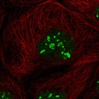 Immunofluorescent staining of human cell line A-431 shows localization to nucleus & nucleoli.