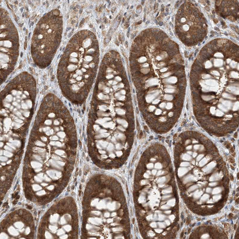 Anti-COMMD8 Antibody