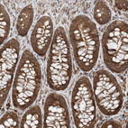 Anti-COMMD8 Antibody