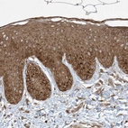Immunohistochemical staining of human skin shows strong cytoplasmic positivity in squamous epithelial cells.