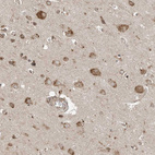 Immunohistochemical staining of human cerebral cortex shows moderate cytoplasmic positivity in neurons.