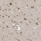 Immunohistochemical staining of human cerebral cortex shows moderate cytoplasmic positivity in neurons.