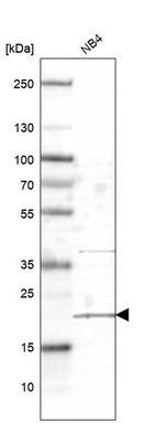 Western blot analysis in human cell line NB4.