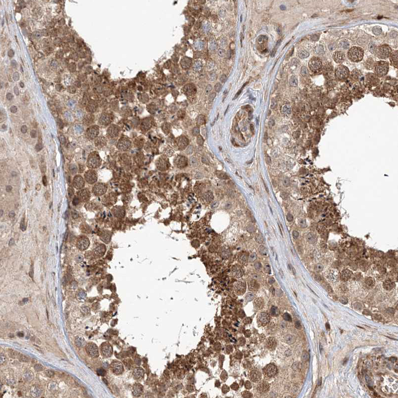 Anti-UBTD2 Antibody