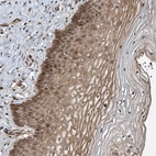 Immunohistochemical staining of human cervix, uterine shows moderate cytoplasmic positivity in squamous epithelial cells.