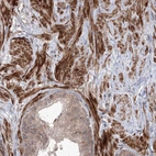 Immunohistochemical staining of human prostate shows moderate to strong cytoplasmic positivity in smooth muscle cells.