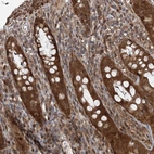 Immunohistochemical staining of human rectum shows strong cytoplasmic positivity in glandular cells.
