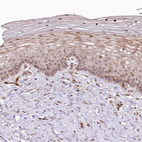 Immunohistochemical staining of human squamous epithelia shows weak to moderate positivity.