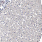 Immunohistochemical staining of human liver shows no positivity in hepatocytes.